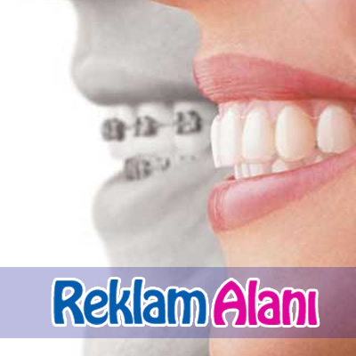 tod-reklam-3 tod-reklam-3